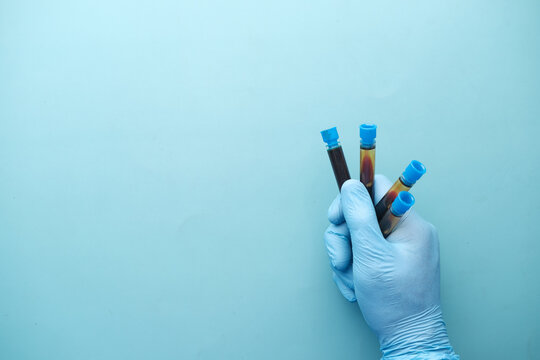 hand in blue medical gloves holding blood test tube