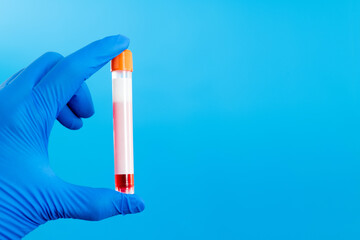 Hand holing a blood test tube with blank label