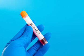 Hand holding blood test tube with word 2019-nCoV