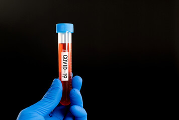 Hand holding blood test tube with word COVID-19