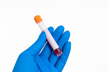 Hand holing a blood test tube with blank label