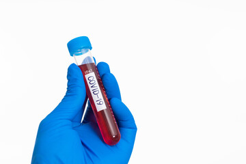 Hand holding blood test tube with word COVID-19