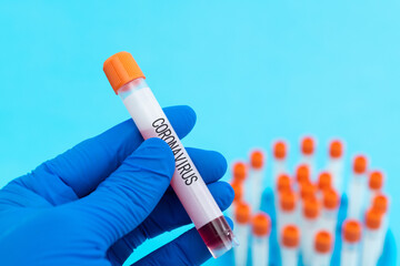 Hand holding blood test tube with word CORONAVIRUS