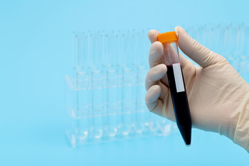 Hand holing a blood test tube with blank label