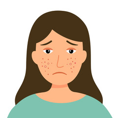 Woman with acne problem on face in flat design on white background. Allergy skin. Pimple facial skin problem.