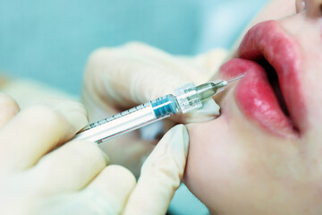 doctor cosmetologist makes an injection into the lips of the woman. lip augmentation procedure...