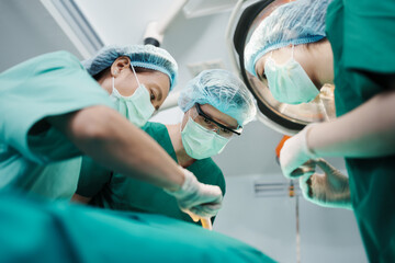 Low Angle Shot of Professional surgeons team performing surgery in operating room, surgeon,...
