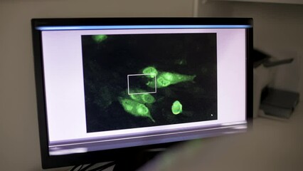 green molecules of a virus or bacteria under a modern electron microscope close-up on a monitor