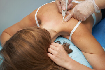 Female patient receiving carboxytherapy treatment in clinic - obrazy, fototapety, plakaty