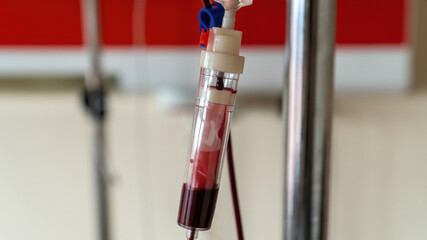 Blood transfusion serum in hospital room with blood drip. Medical concept.