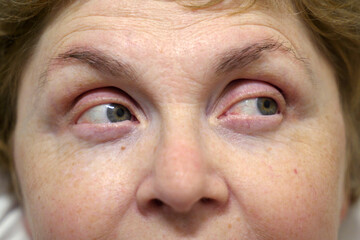 middle-aged woman doing exercises for the eyes, looking away to the right, left, up and down, woman's face