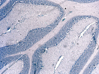Cross section of a cerebellum. Light micrograph. Cresyl Violet Staining (Nissl Staining).