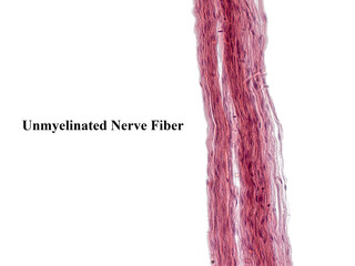 An interesting photo taken with a microscope. Unmyelinated fibers in peripheral nerves....