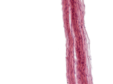 An interesting photo taken with a microscope. Unmyelinated fibers in peripheral nerves. Longitudinal section. Hematoxylin and Eosin Stainit. 