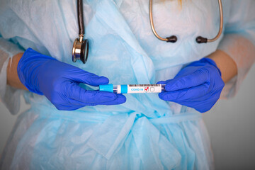 a medical worker holds in his hands a test tube with a positive test result for a covid, close-up.