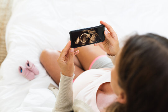 Caucasian pregnant woman holding ultrasound image of her baby at home