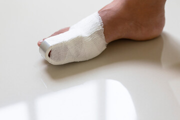 big toe foot after accident on white background.