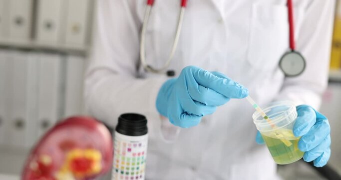 Doctor performs PH test with urinalysis strip closeup