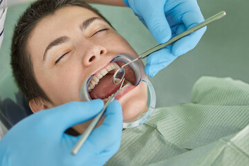 Close up of patient with cheek retractor in mouth receiving dental treatment.