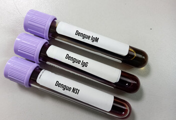 Close view of blood samples for dengue virus (IgG, IgM and NS1) test, Antibody and antigen testing...