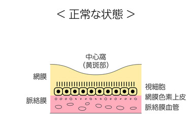 眼病、加齢黄斑変性症の図解、正常な状態