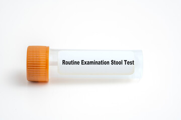 Routine Examination Stool Test