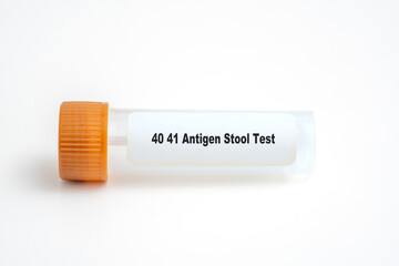 40 41 Antigen Stool Test