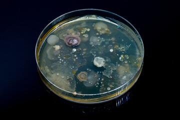 Petri dish with biological samples in a   laboratory of a medical clinic