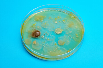 Petri dish with biological samples in a   laboratory of a medical clinic