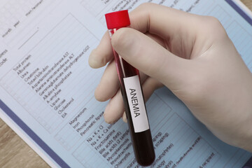 Doctor holding test tube with blood sample and label Anemia over medical form, top view
