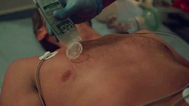 Medical worker hands defibrillating unconscious man in emergency room closeup.