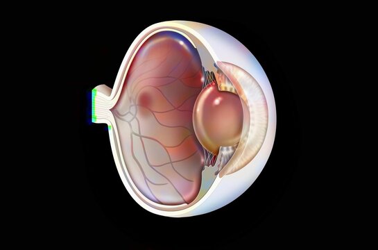 Eye: age-related macular degeneration (degenerative disease.