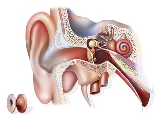 Otitis treatment: tympanic ventilator in the ear to promote.