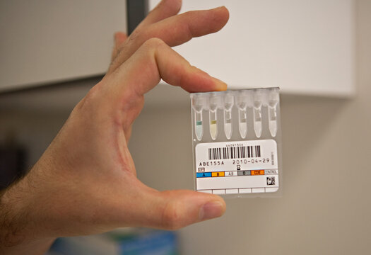 Equipment for determining blood groups in a hospital laboratory.