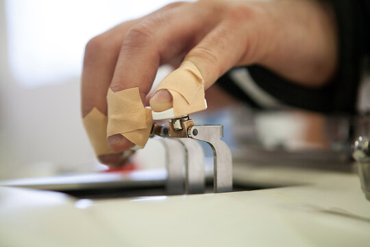 Neurological rehabilitation after stroke and head trauma with robotic.