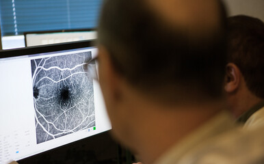 Performing a control angiogram of the eye in an ophthalmology practice.