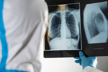 Doctor in a Covid ward of a hospital examining x-rays of the lungs.