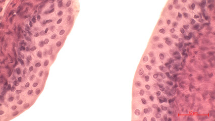 Light microscopy of the internal lining of the urinary bladder. The tissue is a wide transitional...