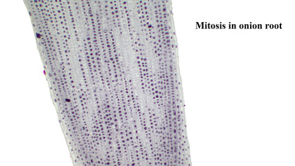 Light photomicrograph of Mitosis in onion root tip cells seen through microscope.  An onion root...