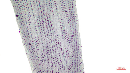 Light photomicrograph of Mitosis in onion root tip cells seen through microscope.  An onion root...