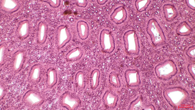 Simple columnar epithelium. Light micrograph of a renal medulla showing several collecting ducts lined by a simple columnar epithelium. 