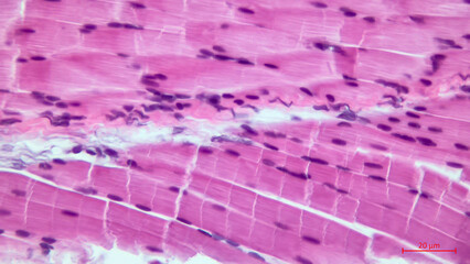 Skeletal striated muscle tissue under the microscope. Muscle fibers. 