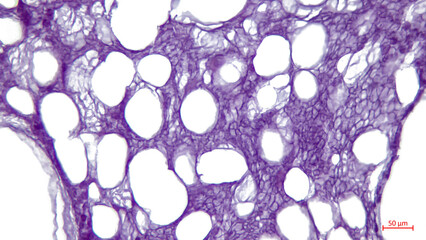 Light microscopy: white adipose tissue of the tubular bone. Large bright holes - the remains of lipocytes. - obrazy, fototapety, plakaty