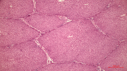 Liver Tissue Under Microscope. Hepatocytes cells form radial sheets, or plates, that may be branched.