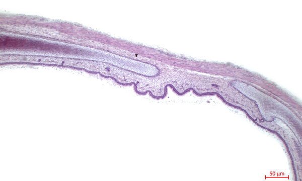 Trachea, light micrograph. Hyaline cartilage from trachea showing chondrocytes, collagen fibers and matrix.