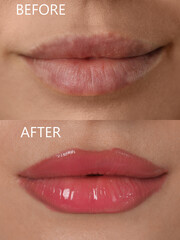 Collage with photos of young woman before and after permanent lip makeup, closeup - obrazy, fototapety, plakaty