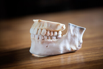 3D printing made from images of a patient. - obrazy, fototapety, plakaty