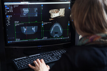 3D reconstruction from a scanner image of a patient's jaw. - obrazy, fototapety, plakaty