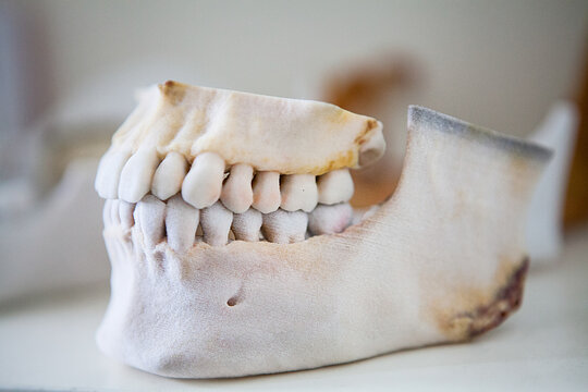 3D printing made from images of a patient.