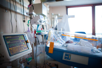 Neonatal Department a newborn in respiratory distress.